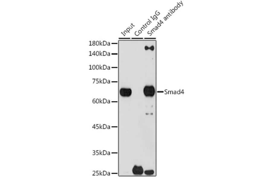 Western Blot - Anti-Smad4 Antibody [ARC5009-06] (A308139) - Antibodies.com