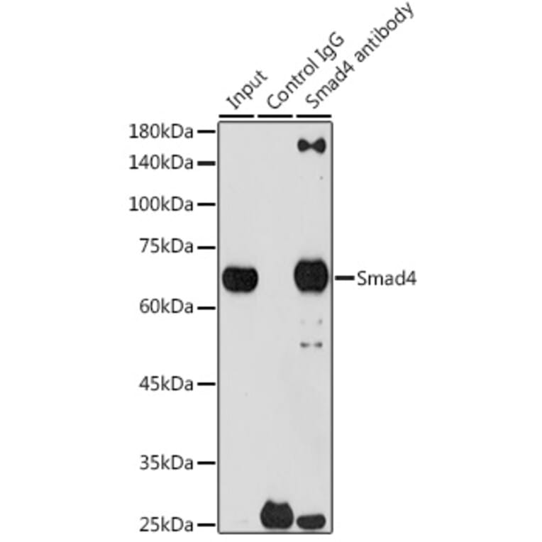 Western Blot - Anti-Smad4 Antibody [ARC5009-06] (A308139) - Antibodies.com