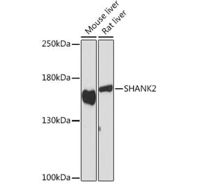 Western Blot - Anti-SHANK2 Antibody (A308140) - Antibodies.com