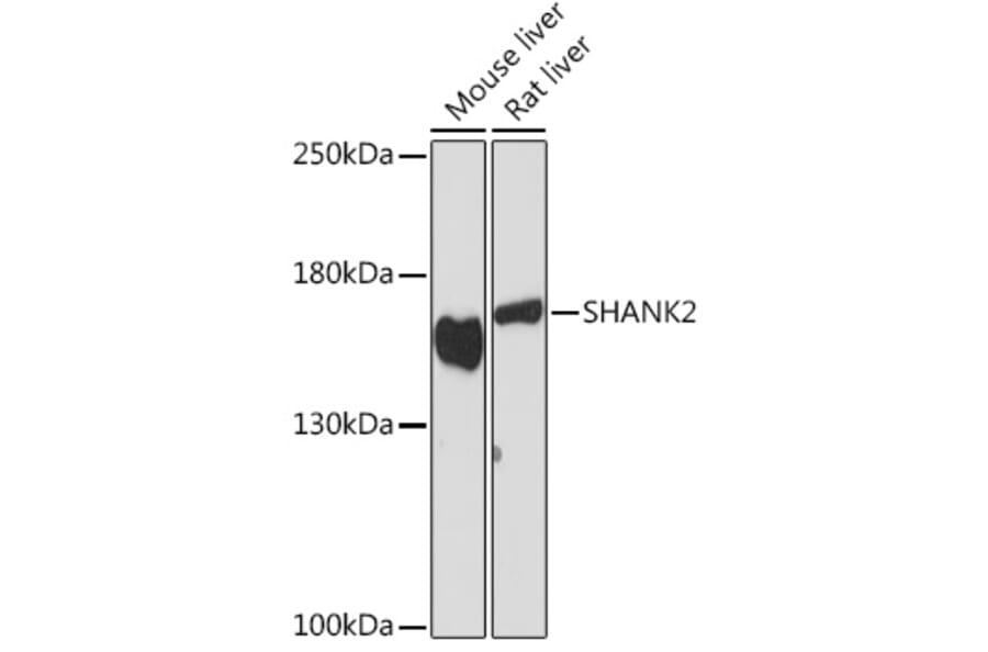 Western Blot - Anti-SHANK2 Antibody (A308140) - Antibodies.com