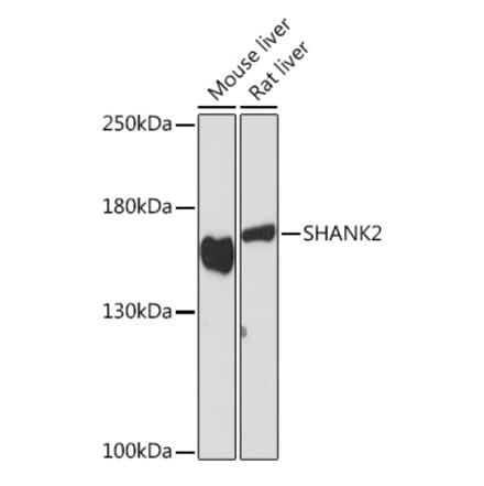 Western Blot - Anti-SHANK2 Antibody (A308140) - Antibodies.com