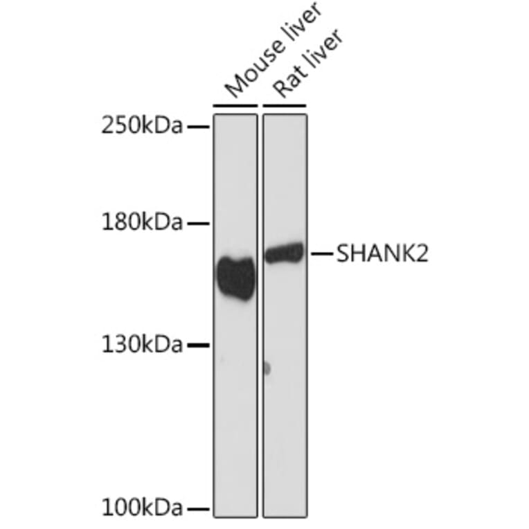 Western Blot - Anti-SHANK2 Antibody (A308140) - Antibodies.com