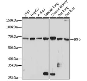 Western Blot - Anti-IRF6 Antibody [ARC1928] (A308141) - Antibodies.com