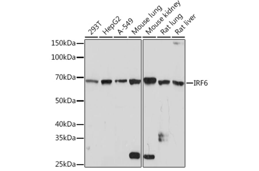 Western Blot - Anti-IRF6 Antibody [ARC1928] (A308141) - Antibodies.com