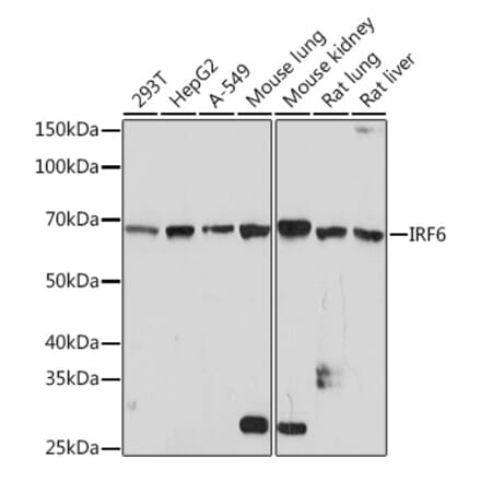 Western Blot - Anti-IRF6 Antibody [ARC1928] (A308141) - Antibodies.com