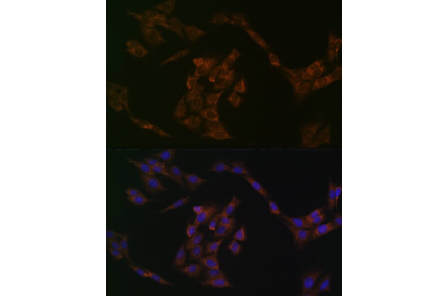Immunofluorescence - Anti-IRF6 Antibody [ARC1928] (A308141) - Antibodies.com