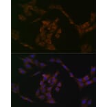 Immunofluorescence - Anti-IRF6 Antibody [ARC1928] (A308141) - Antibodies.com