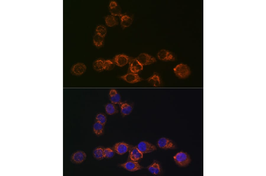 Immunofluorescence - Anti-IRF6 Antibody [ARC1928] (A308141) - Antibodies.com