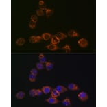 Immunofluorescence - Anti-IRF6 Antibody [ARC1928] (A308141) - Antibodies.com