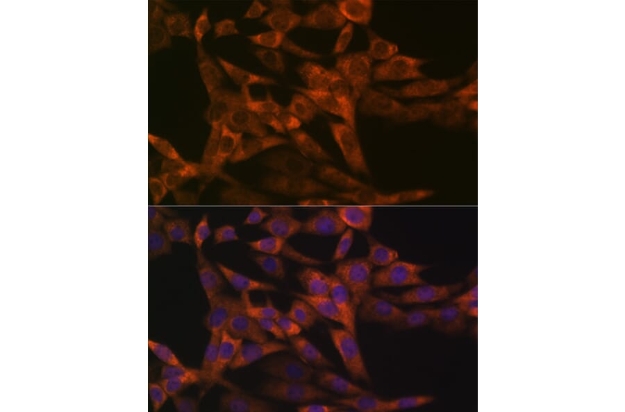 Immunofluorescence - Anti-IRF6 Antibody [ARC1928] (A308141) - Antibodies.com