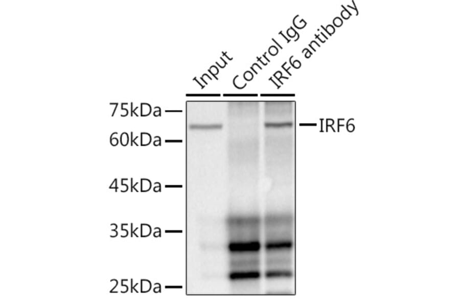 Western Blot - Anti-IRF6 Antibody [ARC1928] (A308141) - Antibodies.com