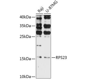 Western Blot - Anti-RPS23 Antibody (A308142) - Antibodies.com