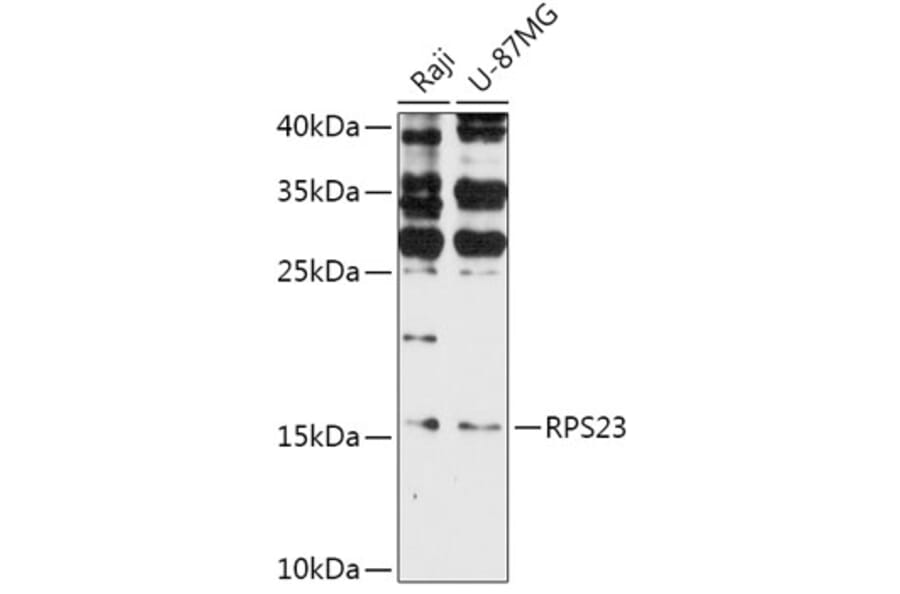 Western Blot - Anti-RPS23 Antibody (A308142) - Antibodies.com
