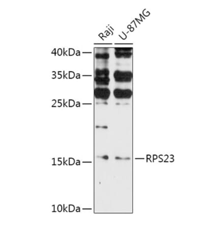 Western Blot - Anti-RPS23 Antibody (A308142) - Antibodies.com