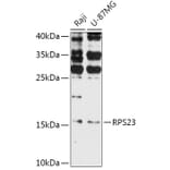 Western Blot - Anti-RPS23 Antibody (A308142) - Antibodies.com