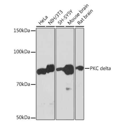 Western Blot - Anti-PKC delta Antibody [ARC1434] (A308143) - Antibodies.com