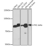 Western Blot - Anti-PKC delta Antibody [ARC1434] (A308143) - Antibodies.com