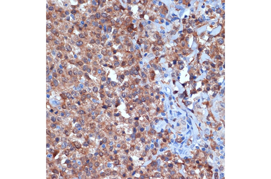 Immunohistochemistry - Anti-PKC delta Antibody [ARC1434] (A308143) - Antibodies.com