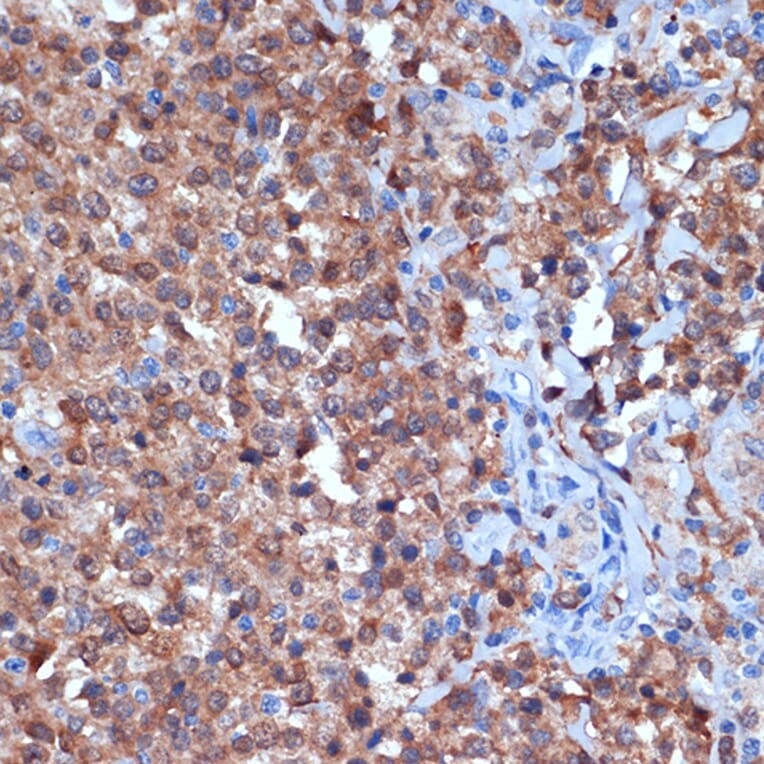 Immunohistochemistry - Anti-PKC delta Antibody [ARC1434] (A308143) - Antibodies.com