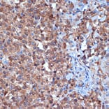 Immunohistochemistry - Anti-PKC delta Antibody [ARC1434] (A308143) - Antibodies.com