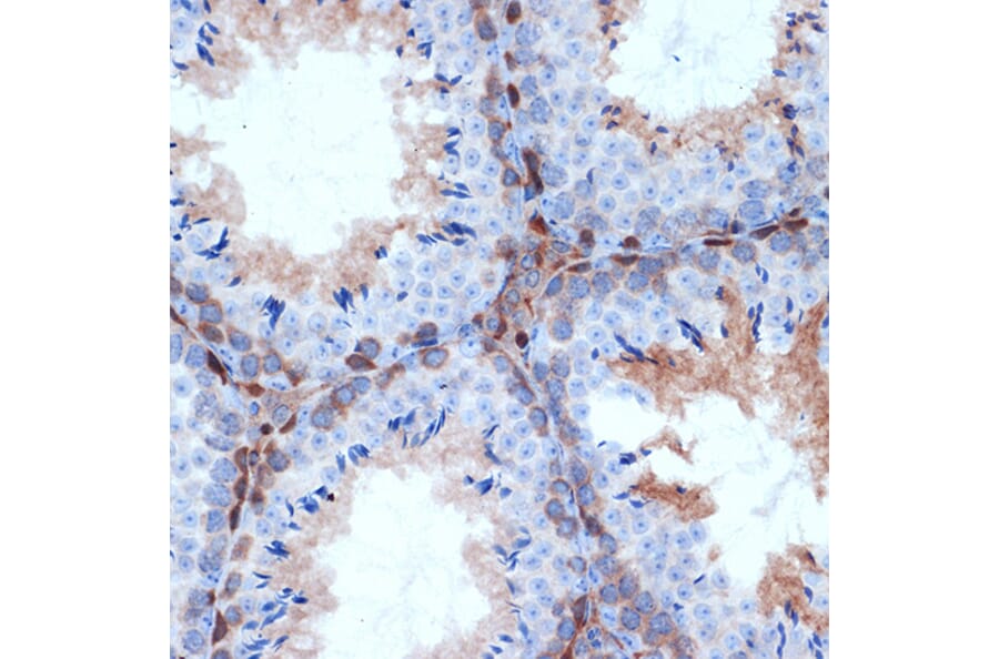 Immunohistochemistry - Anti-PKC delta Antibody [ARC1434] (A308143) - Antibodies.com