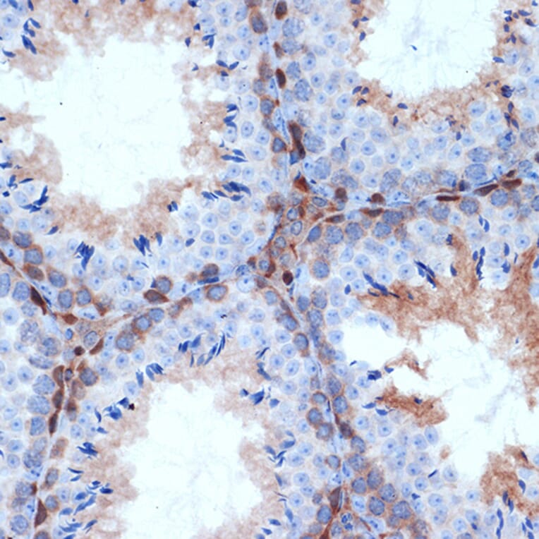 Immunohistochemistry - Anti-PKC delta Antibody [ARC1434] (A308143) - Antibodies.com