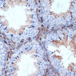 Immunohistochemistry - Anti-PKC delta Antibody [ARC1434] (A308143) - Antibodies.com