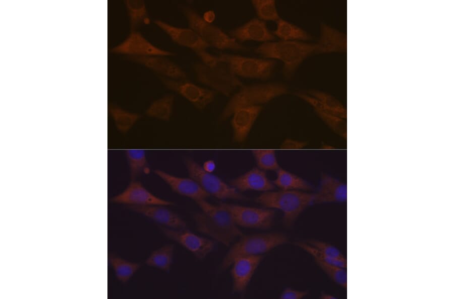 Immunofluorescence - Anti-PKC delta Antibody [ARC1434] (A308143) - Antibodies.com