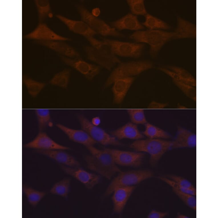 Immunofluorescence - Anti-PKC delta Antibody [ARC1434] (A308143) - Antibodies.com