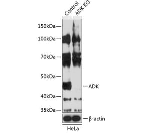 Western Blot - Anti-ADK Antibody (A308144) - Antibodies.com