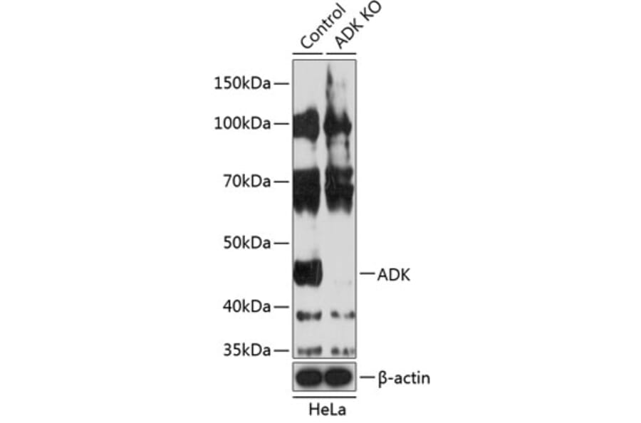 Western Blot - Anti-ADK Antibody (A308144) - Antibodies.com