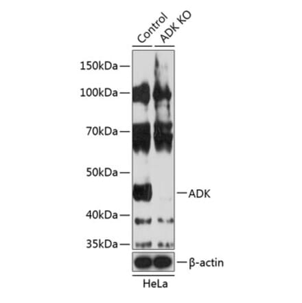Western Blot - Anti-ADK Antibody (A308144) - Antibodies.com