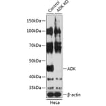 Western Blot - Anti-ADK Antibody (A308144) - Antibodies.com