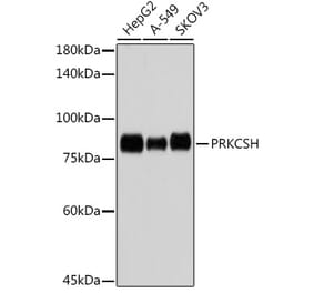 Western Blot - Anti-Glucosidase 2 subunit beta Antibody [ARC2549] (A308145) - Antibodies.com