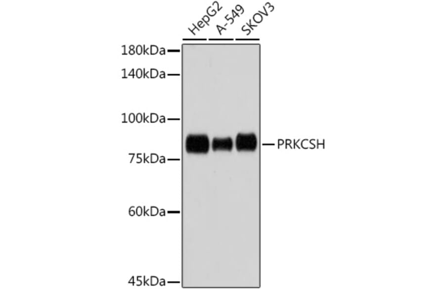 Western Blot - Anti-Glucosidase 2 subunit beta Antibody [ARC2549] (A308145) - Antibodies.com