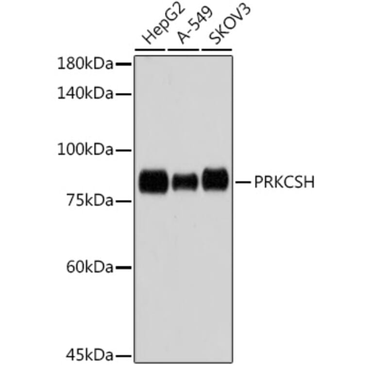 Western Blot - Anti-Glucosidase 2 subunit beta Antibody [ARC2549] (A308145) - Antibodies.com