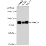 Western Blot - Anti-Glucosidase 2 subunit beta Antibody [ARC2549] (A308145) - Antibodies.com