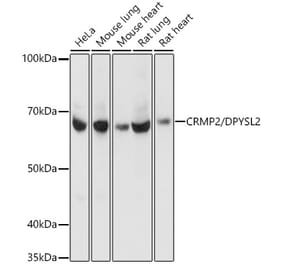 Western Blot - Anti-CRMP2 Antibody [ARC1123] (A308146) - Antibodies.com