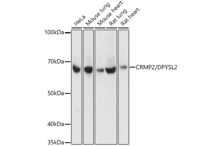Western Blot - Anti-CRMP2 Antibody [ARC1123] (A308146) - Antibodies.com
