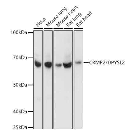 Western Blot - Anti-CRMP2 Antibody [ARC1123] (A308146) - Antibodies.com