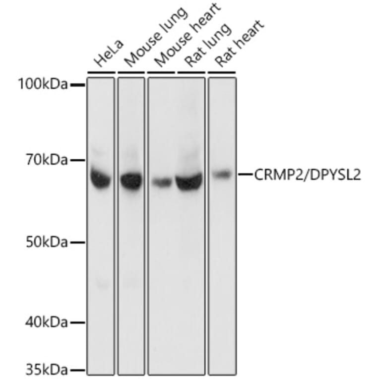 Western Blot - Anti-CRMP2 Antibody [ARC1123] (A308146) - Antibodies.com