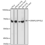 Western Blot - Anti-CRMP2 Antibody [ARC1123] (A308146) - Antibodies.com