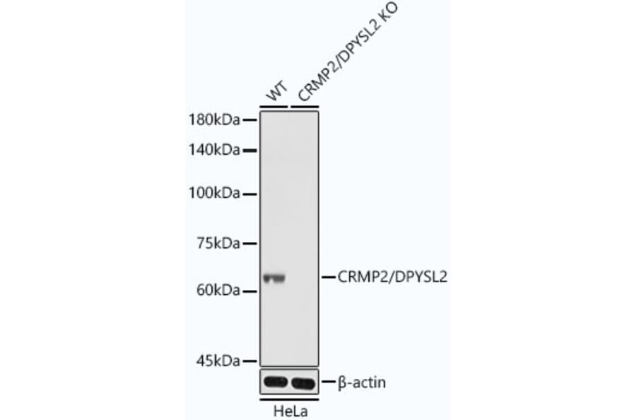 Western Blot - Anti-CRMP2 Antibody [ARC1123] (A308146) - Antibodies.com