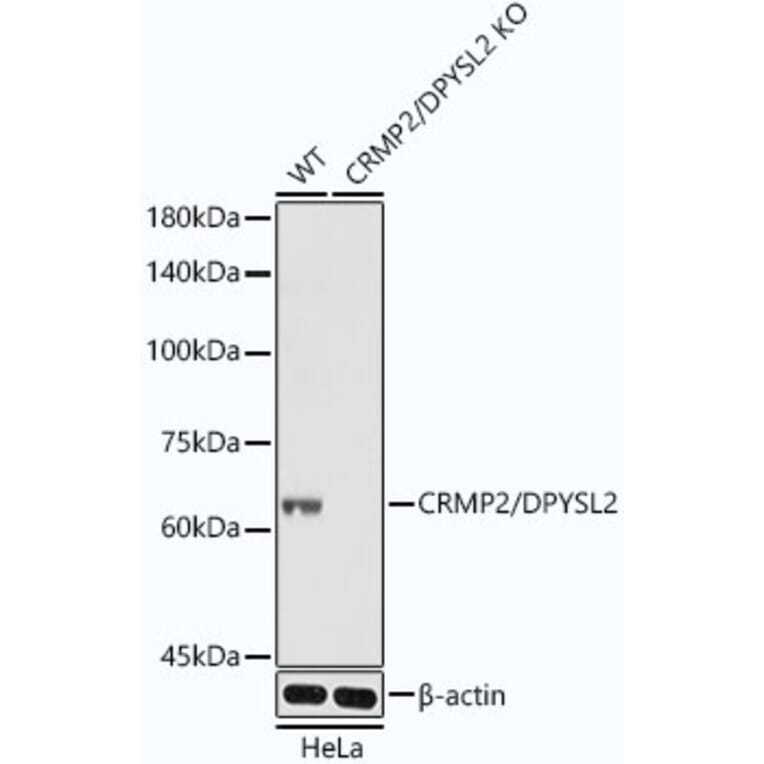 Western Blot - Anti-CRMP2 Antibody [ARC1123] (A308146) - Antibodies.com