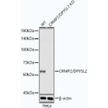 Western Blot - Anti-CRMP2 Antibody [ARC1123] (A308146) - Antibodies.com
