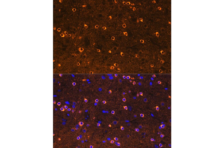 Immunofluorescence - Anti-CRMP2 Antibody [ARC1123] (A308146) - Antibodies.com