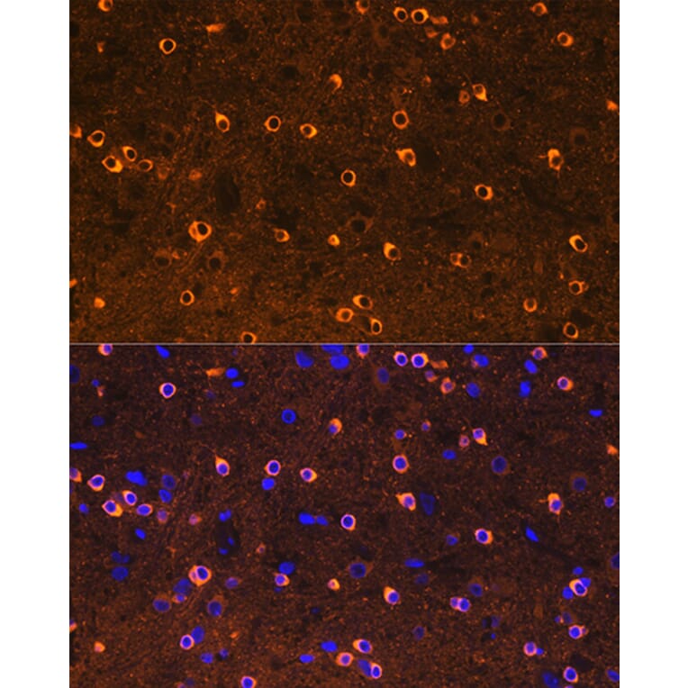 Immunofluorescence - Anti-CRMP2 Antibody [ARC1123] (A308146) - Antibodies.com