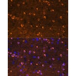 Immunofluorescence - Anti-CRMP2 Antibody [ARC1123] (A308146) - Antibodies.com
