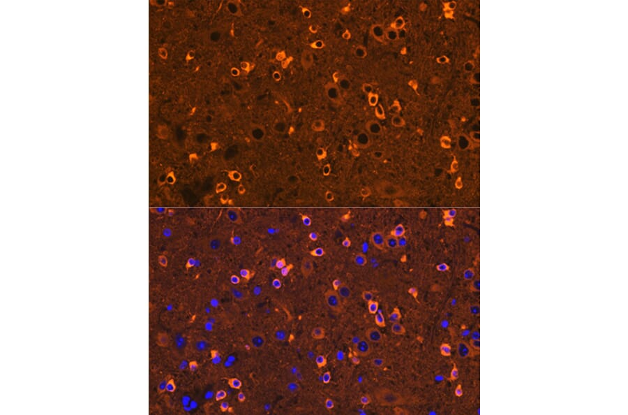 Immunofluorescence - Anti-CRMP2 Antibody [ARC1123] (A308146) - Antibodies.com