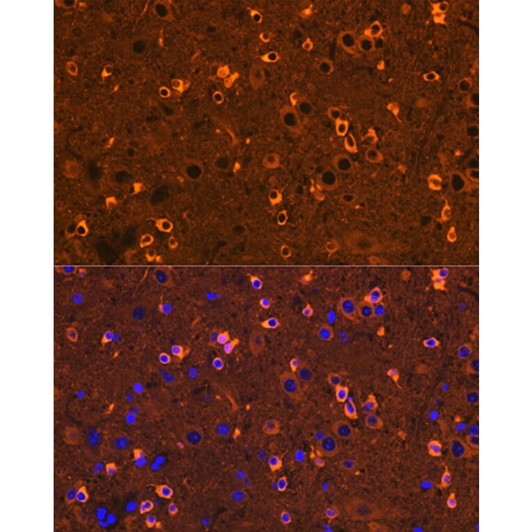 Immunofluorescence - Anti-CRMP2 Antibody [ARC1123] (A308146) - Antibodies.com